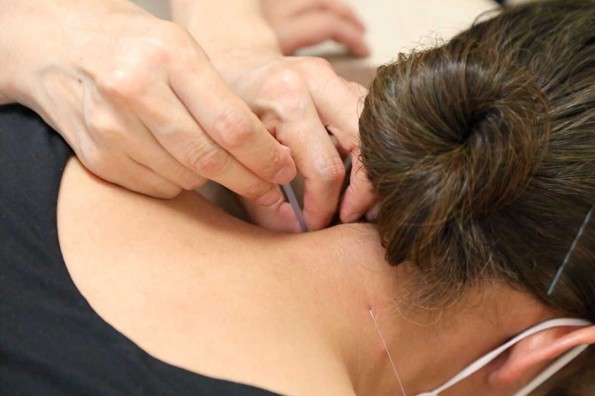 自然治癒力を高める鍼治療