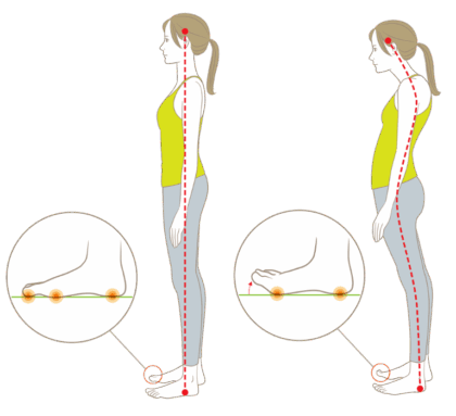 インソールで足を整えることが重要な理由