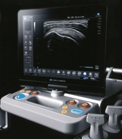 超音波検査（エコー検査）